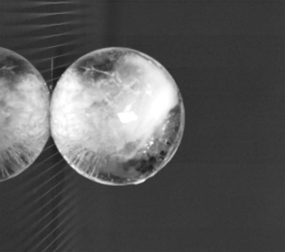 X-ray video image Screenshot of X-ray video image.