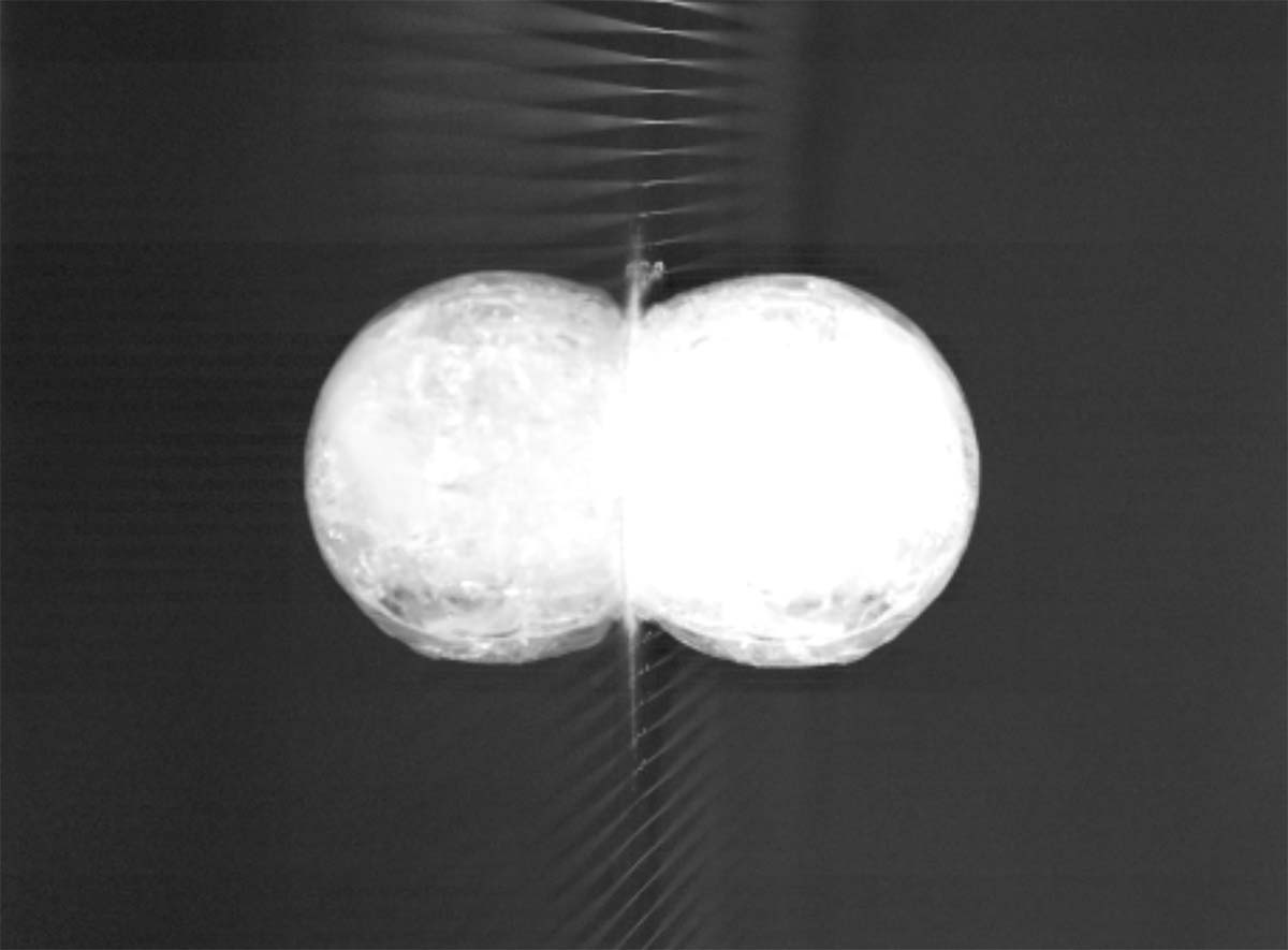 X-ray video image Screenshot of X-ray video image.